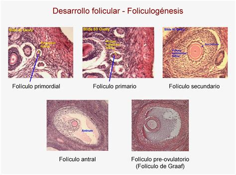 folículos subcentimétricos